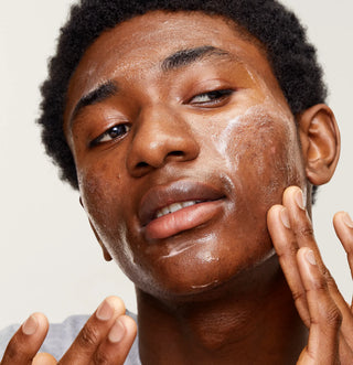 Top Non prescription Acne Treatments