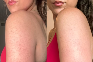 How to Smooth Bumpy & Rough Skin on Arms