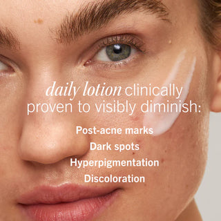 Ultimate Acne Solutions Routine