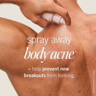 Ultimate Acne Solutions Routine