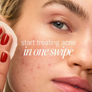 Acne Clearing Pads with 2% Salicylic Acid