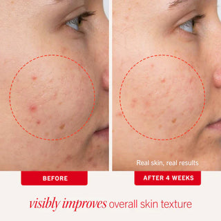 Clear Up + Hydrate Trio