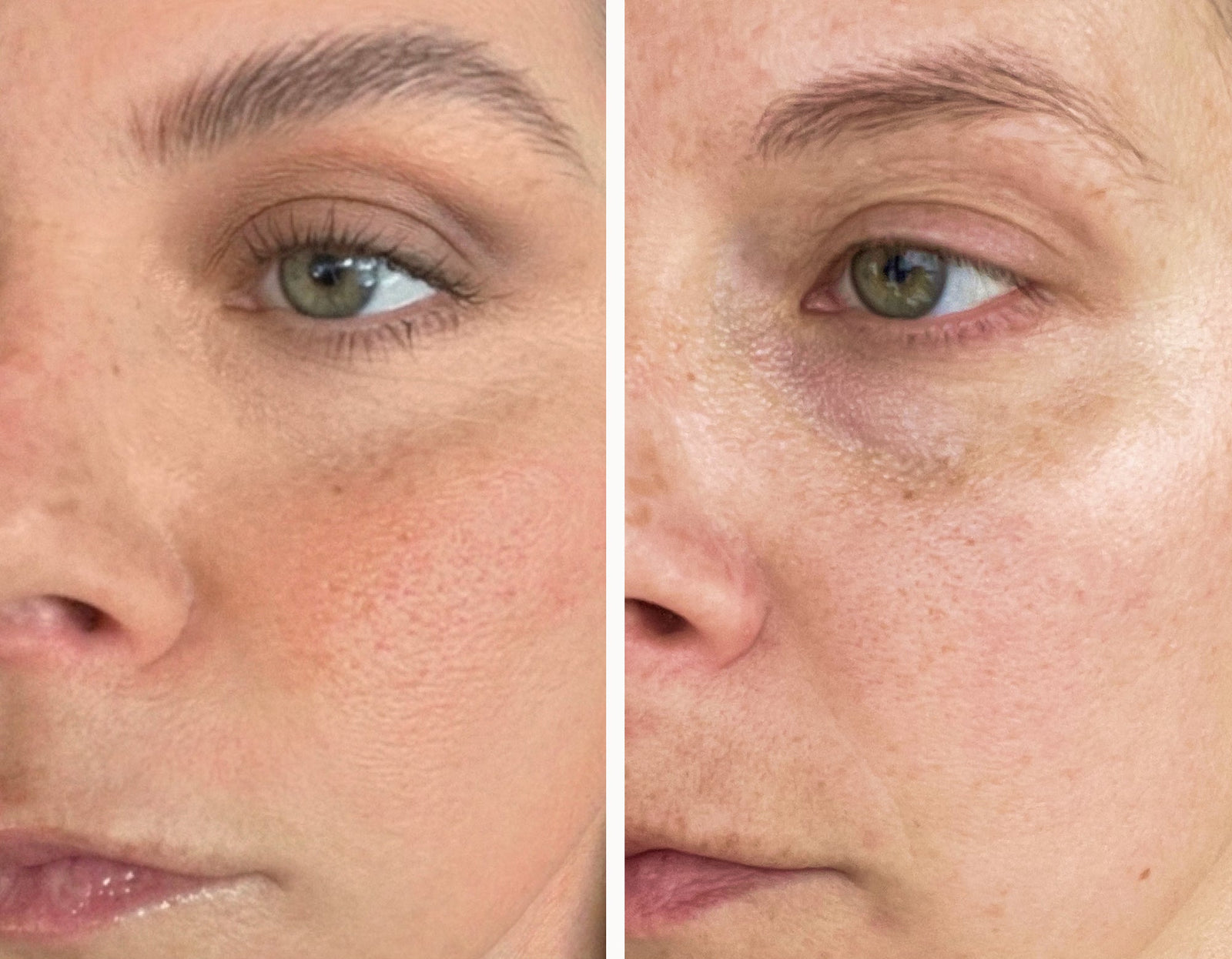Real Skin, Real Results
