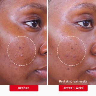 Clear Up + Hydrate Trio