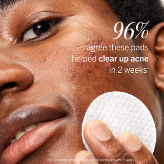 Acne Clearing Pads with 2% Salicylic Acid