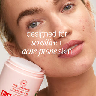 Acne Clearing Pads with 2% Salicylic Acid