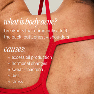 Ultimate Acne Solutions Routine