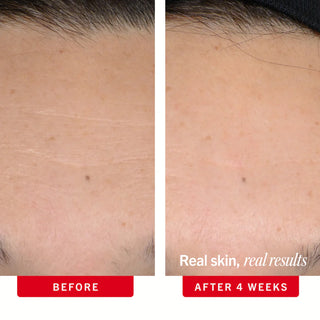 Face-Firming Duo
