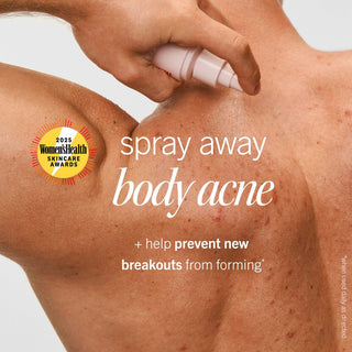 Body Acne Clearing Mist with 2% Salicylic Acid