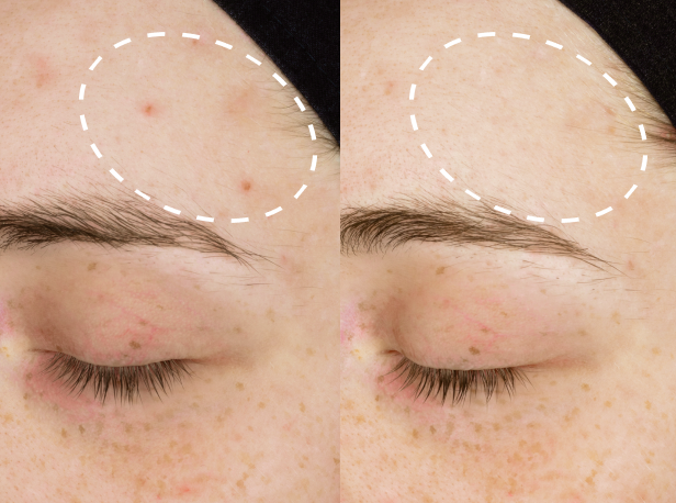 Real Skin, Real Results