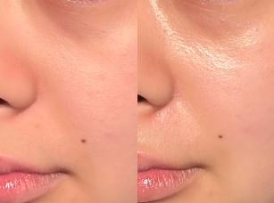 Real Skin, Real Results