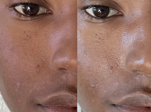 Real Skin, Real Results