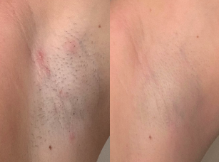 Real Skin, Real Results