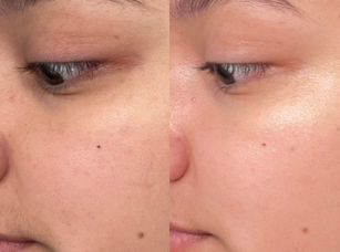 Real Skin, Real Results