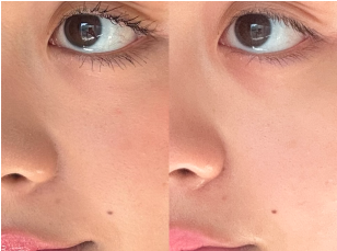 Real Skin, Real Results