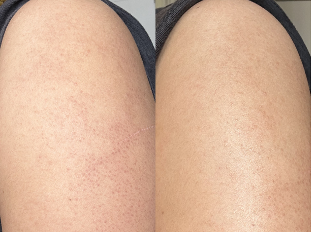 Real Skin, Real Results