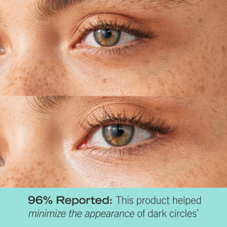 Product Claim: 96% reported this product helped minimize the appearance of dark circles. 