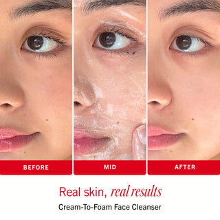 Sensitive Skin Bestsellers