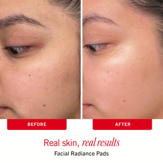 Sensitive Skin Bestsellers