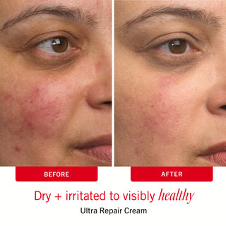 Sensitive Skin Bestsellers