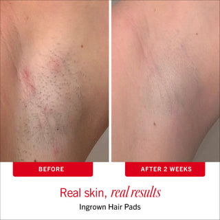Smooth Skin Body Bestsellers