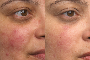 Real Skin, Real Results