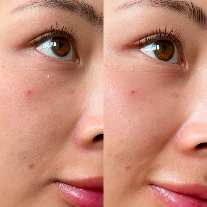 Real Skin, Real Results