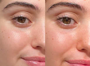 Real Skin, Real Results
