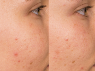 Real Skin, Real Results