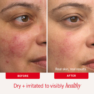 Soothe + Protect Duo